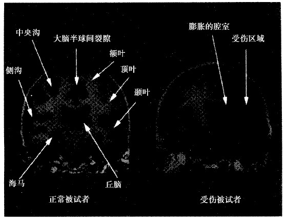 2 - 图14