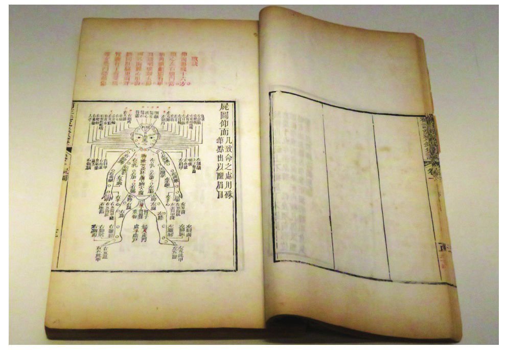 60 古代法医如何尸检？ - 图1