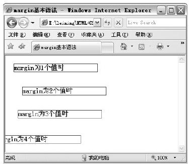 第20章　设置外补丁 - 图1